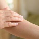 Une main de femme effleure délicatement l'avant-bras, où une légère rougeur diffuse indique une irritation cutanée.