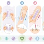 Mésobotox : la technique de botox dilué pour un résultat naturel — à qui c’est vraiment destiné découvrez comment utiliser correctement les bandes de cire froide pour une épilation efficace et sans irritations. conseils pratiques et astuces pour une peau douce et protégée.