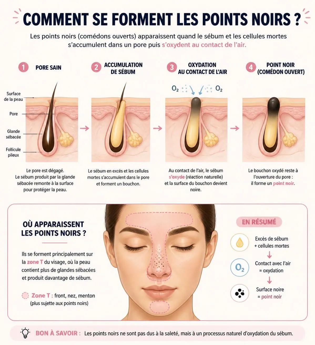 découvrez la méthode efficace et douce pour extraire les points noirs sur le nez sans agresser votre peau, et retrouvez un teint net et lumineux.