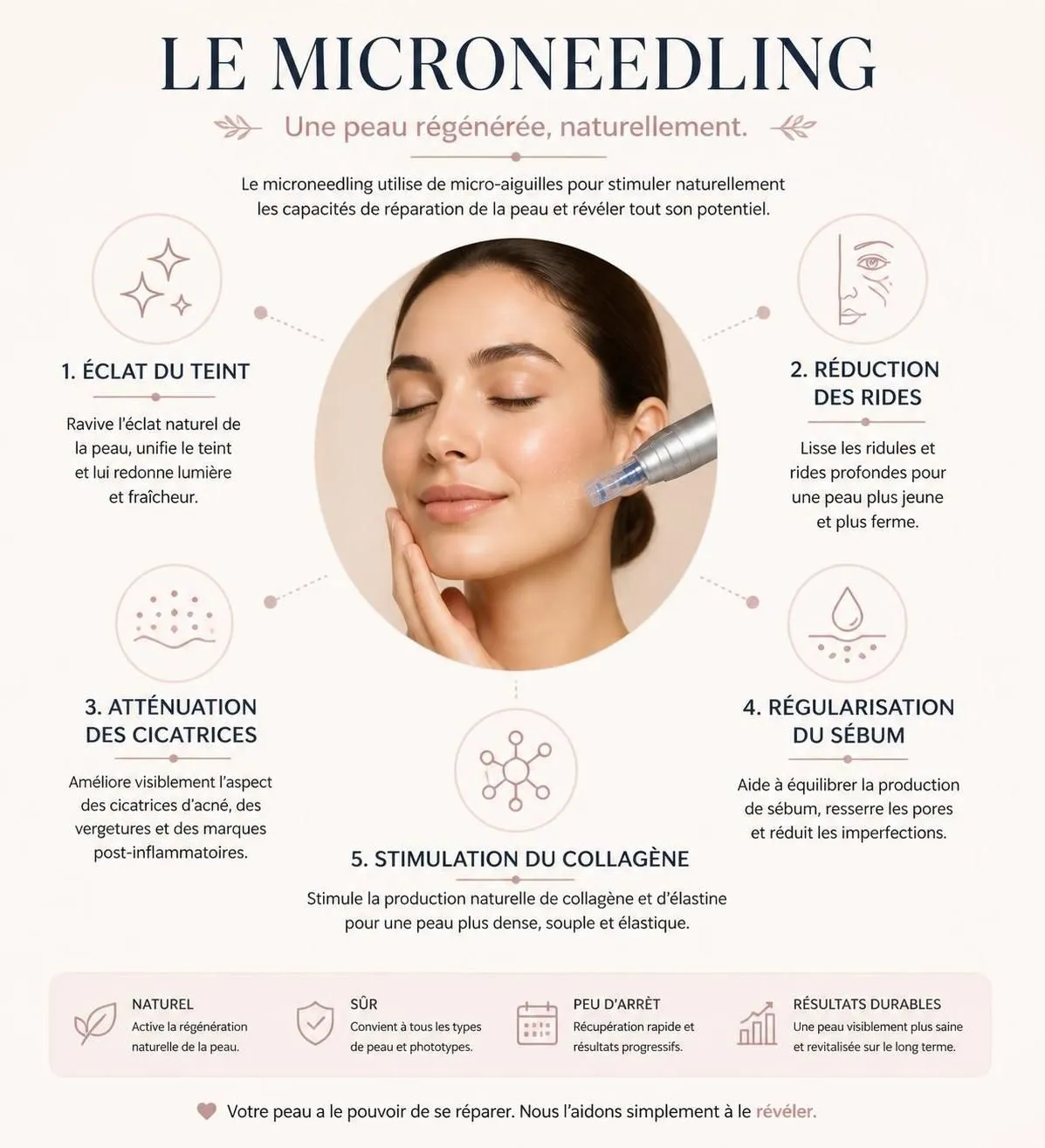découvrez comment se déroule une séance de microneedling, ses bienfaits pour revitaliser votre peau et la durée des résultats pour une peau éclatante et renouvelée.