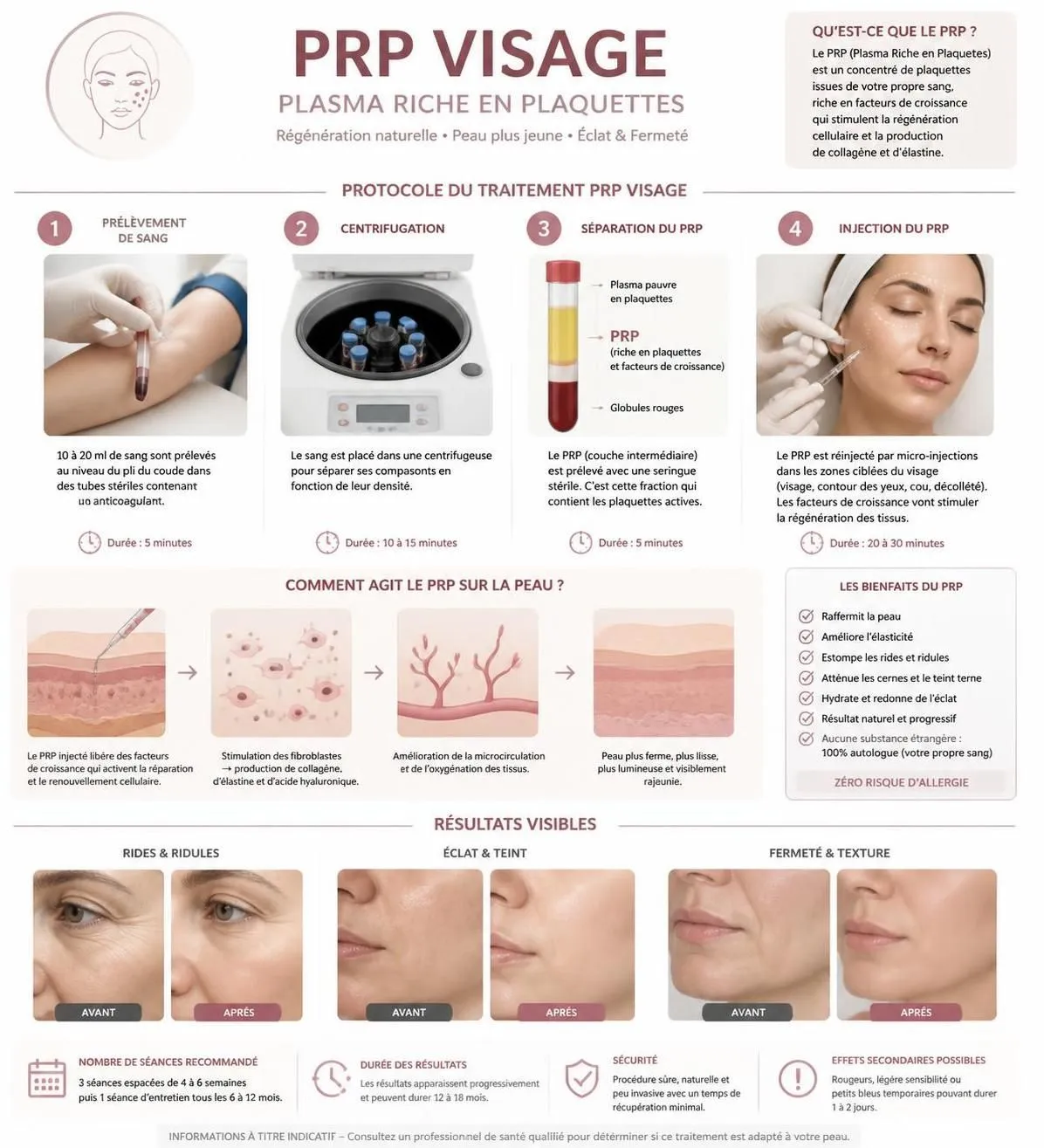 découvrez le traitement prp visage et plasma riche en plaquettes : à qui il s'adresse, ses bienfaits, et comment il peut transformer votre peau en stimulant son renouvellement naturel.