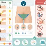 découvrez les méthodes d'épilation du maillot pour homme les moins douloureuses et apprenez quelles erreurs éviter pour un résultat optimal et sans douleur.